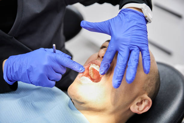 Best Emergency Tooth Extraction in Ddleville, MI